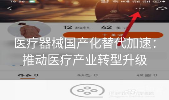 医疗器械国产化替代加速：推动医疗产业转型升级